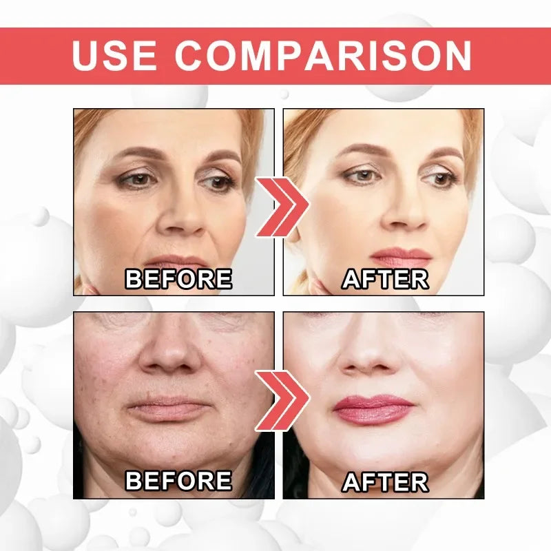 Hyaluronic Acid Anti-Aging Serum for Women Whitening Anti-wrinkle Cream Unisex Facial Collagen Boost Cream Firming Face Care