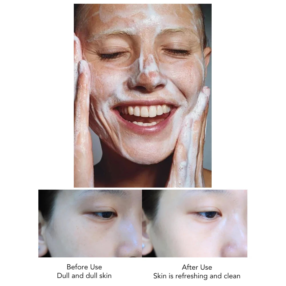 AILKE Rose Facial Cleanser Women Whitening Moisturizing Cleaning Cleaner Hydrating Anti-Dark Spots, Oil Control Face Care Scrub