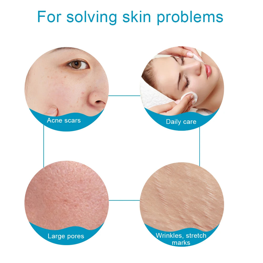 Skin Facial Care Microneedle Derma Roller for Hair Growth Beard Growth Facial Beauty Roller 540 Micro Needle Dermaroller Tool